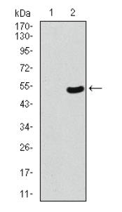 TP53BP1 / 53BP1 Antibody - Western Blot: 53BP1 Antibody (6B3E10) - Western blot analysis using TP53BP1 mAb against HEK293 (1) and TP53BP1 (AA: 574-773)-hIgGFc transfected HEK293 (2) cell lysate.