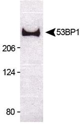 TP53BP1 / 53BP1 Antibody - 53BP1 Antibody - Figure 1 illustrates Western blot detection of 53BP1 (220 kDa) from untreated U2OS cell lysate.  This image was taken for the unconjugated form of this product. Other forms have not been tested.
