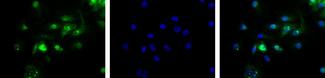 TP53BP1 / 53BP1 Antibody - Immunocytochemistry of human 53BP1. Sample: Whole cell lysate (20 ug/lane) from U2Os cells resolved on a 3 to 8% Tris acetate gel.  This image was taken for the unconjugated form of this product. Other forms have not been tested.