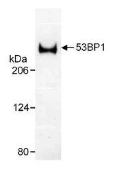 TP53BP1 / 53BP1 Antibody - Western blot of human 53BP1. Sample: Whole cell lysate (20 ug/lane) from U2Os cells resolved on a 3 to 8% Tris acetate gel.  This image was taken for the unconjugated form of this product. Other forms have not been tested.