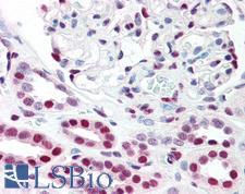 TP53BP1 / 53BP1 Antibody - Anti-TP53BP1 / 53BP1 antibody IHC of human kidney. Immunohistochemistry of formalin-fixed, paraffin-embedded tissue after heat-induced antigen retrieval. Antibody concentration 5 ug/ml.  This image was taken for the unconjugated form of this product. Other forms have not been tested.