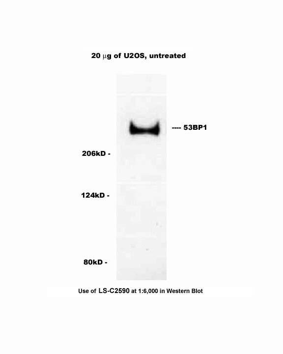 TP53BP1 / 53BP1 Antibody -  This image was taken for the unconjugated form of this product. Other forms have not been tested.