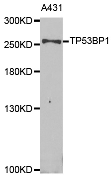TP53BP1 / 53BP1 Antibody - Western blot analysis of extracts of A431 cells.