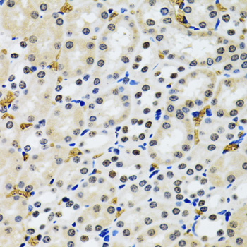 TP53BP1 / 53BP1 Antibody - Immunohistochemistry of paraffin-embedded rat kidney tissue.