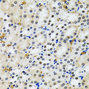 TP53BP1 / 53BP1 Antibody - Immunohistochemistry of paraffin-embedded rat kidney tissue.