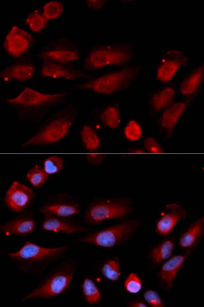 TP53BP1 / 53BP1 Antibody - Immunofluorescence analysis of U2OS cells.