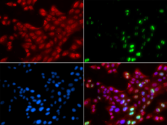 TP53BP1 / 53BP1 Antibody - Immunofluorescence analysis of GFP-RNF168 trangenic U2OS cells.