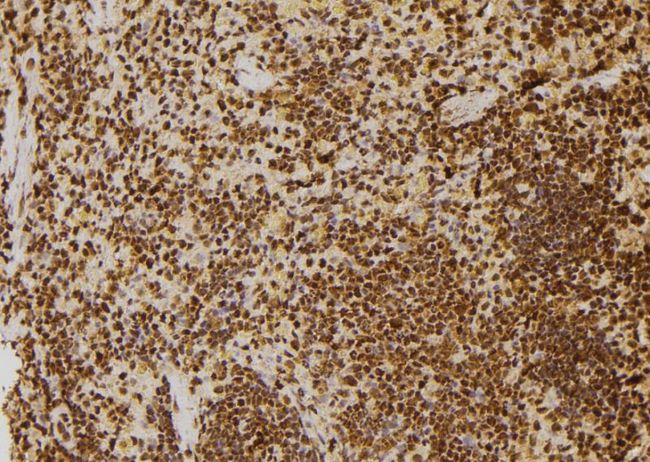 TP53BP1 / 53BP1 Antibody - 1:100 staining rat spleen tissue by IHC-P. The sample was formaldehyde fixed and a heat mediated antigen retrieval step in citrate buffer was performed. The sample was then blocked and incubated with the antibody for 1.5 hours at 22°C. An HRP conjugated goat anti-rabbit antibody was used as the secondary.