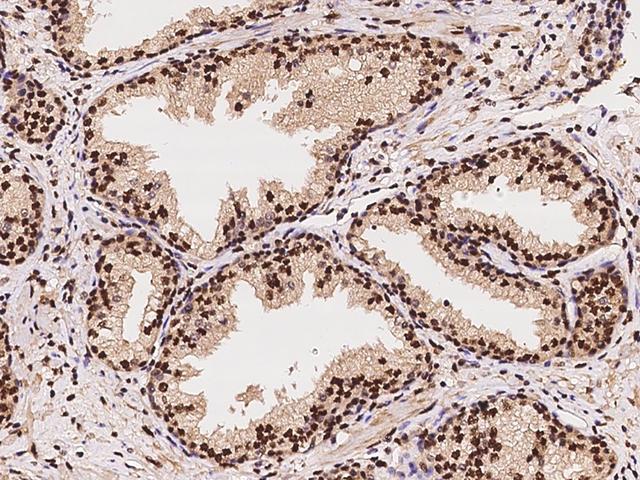TP53BP1 / 53BP1 Antibody - Immunochemical staining of human TP53BP1 in human prostate with rabbit polyclonal antibody at 1:500 dilution, formalin-fixed paraffin embedded sections.