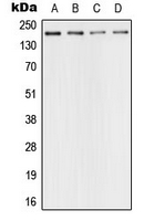 TP53BP1 / 53BP1 Antibody - Western blot analysis of 53BP1 expression in HeLa (A); SP2/0 (B); PC12 (C); rat kidney (D) whole cell lysates.
