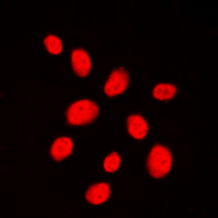 TP53BP1 / 53BP1 Antibody - Immunofluorescent analysis of 53BP1 staining in HeLa cells. Formalin-fixed cells were permeabilized with 0.1% Triton X-100 in TBS for 5-10 minutes and blocked with 3% BSA-PBS for 30 minutes at room temperature. Cells were probed with the primary antibody in 3% BSA-PBS and incubated overnight at 4 C in a humidified chamber. Cells were washed with PBST and incubated with a DyLight 594-conjugated secondary antibody (red) in PBS at room temperature in the dark. DAPI was used to stain the cell nuclei (blue).