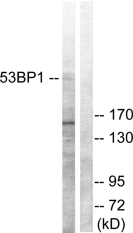 TP53BP1 / 53BP1 Antibody - Western blot analysis of extracts from A549 cells, using 53BP1 (Ab-6) antibody.