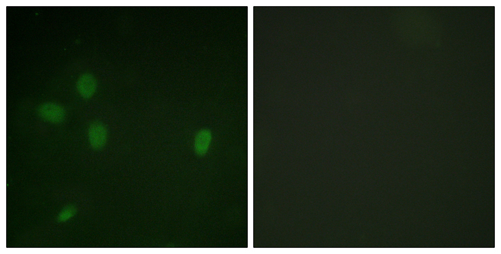 TP53BP1 / 53BP1 Antibody - Immunofluorescence analysis of NIH/3T3 cells, using 53BP1 (Phospho-Ser25) Antibody. The picture on the right is blocked with the phospho peptide.