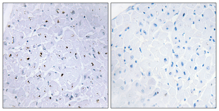 TP53BP1 / 53BP1 Antibody - Immunohistochemistry analysis of paraffin-embedded human heart, using 53BP1 (Phospho-Ser6) Antibody. The picture on the right is blocked with the phospho peptide.
