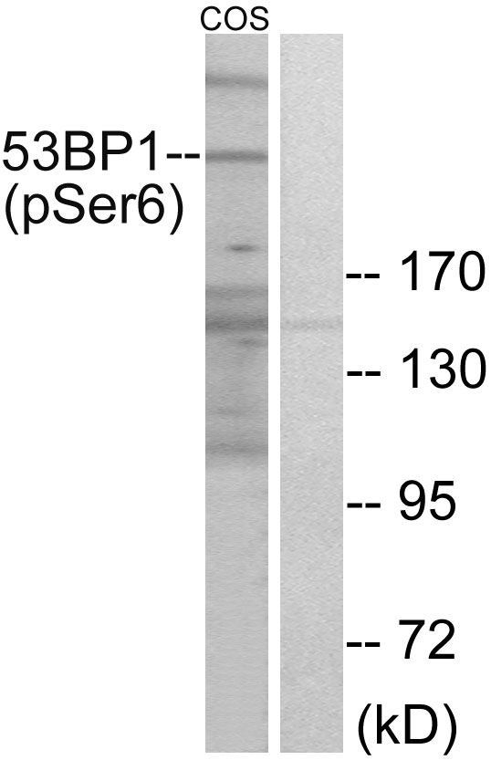 TP53BP1 / 53BP1 Antibody - Western blot analysis of lysates from COS7 cells treated with insulin 0.01U/ML 15', using 53BP1 (Phospho-Ser6) Antibody. The lane on the right is blocked with the phospho peptide.