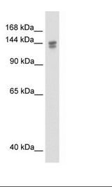TP53BP2 / ASPP2 Antibody - Fetal Thymus Lysate.  This image was taken for the unconjugated form of this product. Other forms have not been tested.