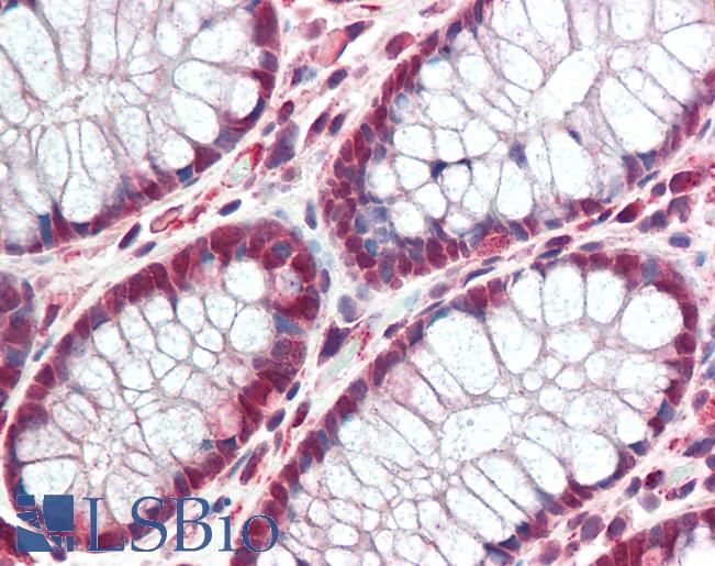 TP53BP2 / ASPP2 Antibody - Anti-TP53BP2 / ASPP2 antibody IHC staining of human colon. Immunohistochemistry of formalin-fixed, paraffin-embedded tissue after heat-induced antigen retrieval. Antibody concentration 10 ug/ml.  This image was taken for the unconjugated form of this product. Other forms have not been tested.