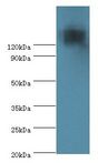 TP53BP2 / ASPP2 Antibody - Western blot. All lanes: TP53BP2 antibody at 2 ug/ml+mouse thymus. Secondary antibody: Goat polyclonal to rabbit at 1:10000 dilution. Predicted band size: 126 kDa. Observed band size: 126 kDa.
