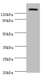 TP53BP2 / ASPP2 Antibody - Western blot All lanes: TP53BP2 antibody at 2µg/ml + Mouse thymus Secondary Goat polyclonal to rabbit IgG at 1/10000 dilution Predicted band size: 126, 112, 127 kDa Observed band size: 126 kDa
