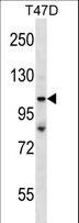 TP53BP2 / ASPP2 Antibody - TP53BP2 Antibody western blot of T47D cell line lysates (35 ug/lane). The TP53BP2 antibody detected the TP53BP2 protein (arrow).
