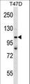 TP53BP2 / ASPP2 Antibody - TP53BP2 Antibody western blot of T47D cell line lysates (35 ug/lane). The TP53BP2 antibody detected the TP53BP2 protein (arrow).