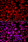 TP53BP2 / ASPP2 Antibody - Immunofluorescence analysis of A549 cells.
