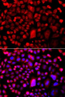 TP53BP2 / ASPP2 Antibody - Immunofluorescence analysis of A549 cells.