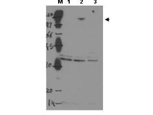 TP53BP2 / ASPP2 Antibody - Anti-ASPP2 Antibody - Western Blot. Western blot of Protein A purified anti-ASPP2 to detect over-expressed ASPP2 in MCF-7 cells (Lane 2, arrowhead). Lane 1 is a nontransfected control. Lane 3 is MCF-7 cells over-expressing ASPP1. Cell extracts were electrophoresed and transferred to nitrocellulose. The membrane was probed with the primary antibody at a 1:1000 dilution. The identity of the lower MW band at approximately 40kD is unknown. Personal Communication, H. Yang, Univ. Oklahoma, Oklahoma City, OK.