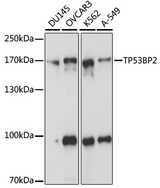 TP53BP2 / ASPP2 Antibody - Western blot analysis of extracts of various cell lines, using TP53BP2 antibody at 1:1000 dilution. The secondary antibody used was an HRP Goat Anti-Rabbit IgG (H+L) at 1:10000 dilution. Lysates were loaded 25ug per lane and 3% nonfat dry milk in TBST was used for blocking. An ECL Kit was used for detection and the exposure time was 1s.
