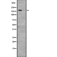 TP53BP2 / ASPP2 Antibody - Western blot analysis of ASPP2 expression in HEK293 cells. The lane on the left is treated with the antigen-specific peptide.