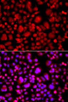 TP53BP2 / ASPP2 Antibody - Immunofluorescence analysis of A549 cells using TP53BP2 Polyclonal Antibody.