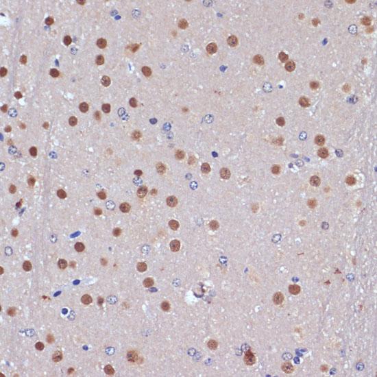 TP53BP2 / ASPP2 Antibody - Immunohistochemistry of paraffin-embedded Mouse brain using TP53BP2 Polyclonal Antibody at dilution of 1:100 (40x lens).