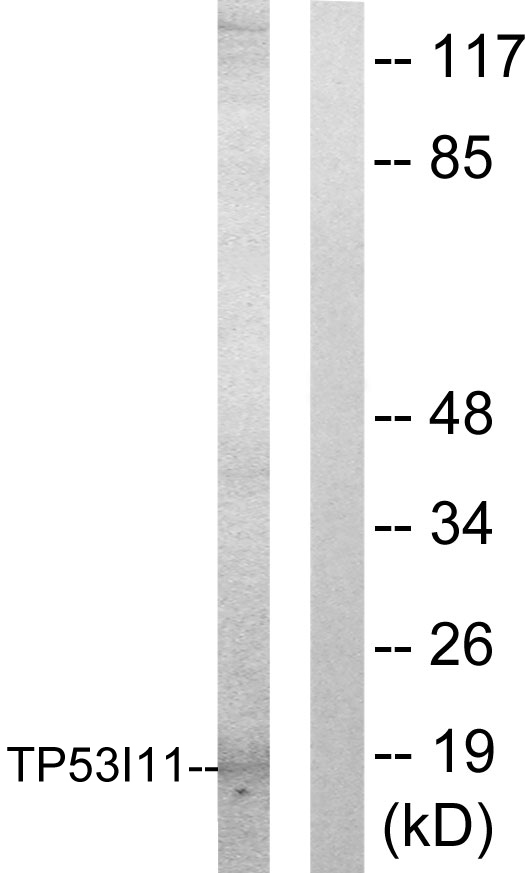 TP53I11 / PIG11 Antibody - Western blot analysis of lysates from HUVEC cells, using TP53I11 Antibody. The lane on the right is blocked with the synthesized peptide.
