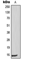 TP53I11 / PIG11 Antibody - Western blot analysis of PIG11 expression in HUVEC (A) whole cell lysates.