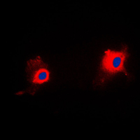 TP53I11 / PIG11 Antibody - Immunofluorescent analysis of PIG11 staining in HUVEC cells. Formalin-fixed cells were permeabilized with 0.1% Triton X-100 in TBS for 5-10 minutes and blocked with 3% BSA-PBS for 30 minutes at room temperature. Cells were probed with the primary antibody in 3% BSA-PBS and incubated overnight at 4 C in a humidified chamber. Cells were washed with PBST and incubated with a DyLight 594-conjugated secondary antibody (red) in PBS at room temperature in the dark. DAPI was used to stain the cell nuclei (blue).
