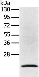 TP53I11 / PIG11 Antibody - Western blot analysis of Jurkat cell, using TP53I11 Polyclonal Antibody at dilution of 1:400.