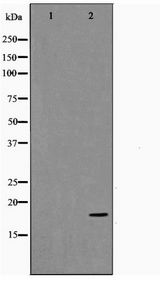 TP53I11 / PIG11 Antibody - Western blot of HUVEC cell lysate using TP53I11 Antibody
