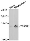 TP53I11 / PIG11 Antibody - Western blot analysis of extracts of various cell lines, using TP53I11 antibody at 1:3000 dilution. The secondary antibody used was an HRP Goat Anti-Rabbit IgG (H+L) at 1:10000 dilution. Lysates were loaded 25ug per lane and 3% nonfat dry milk in TBST was used for blocking. An ECL Kit was used for detection and the exposure time was 90s.