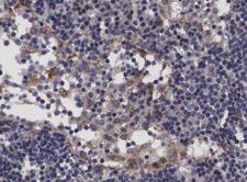 TP53I11 / PIG11 Antibody - 1:100 staining human lymph node tissue by IHC-P. The tissue was formaldehyde fixed and a heat mediated antigen retrieval step in citrate buffer was performed. The tissue was then blocked and incubated with the antibody for 1.5 hours at 22°C. An HRP conjugated goat anti-rabbit antibody was used as the secondary.