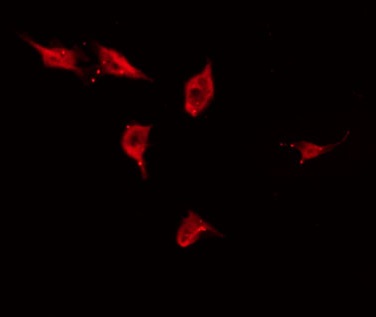 TP53I11 / PIG11 Antibody - Staining HuvEc cells by IF/ICC. The samples were fixed with PFA and permeabilized in 0.1% Triton X-100, then blocked in 10% serum for 45 min at 25°C. The primary antibody was diluted at 1:200 and incubated with the sample for 1 hour at 37°C. An Alexa Fluor 594 conjugated goat anti-rabbit IgG (H+L) Ab, diluted at 1/600, was used as the secondary antibody.