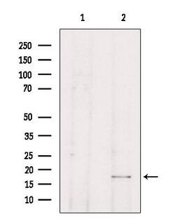 TP53I11 / PIG11 Antibody - Western blot analysis of extracts of HepG2 cells using TP53I11 antibody. Lane 1 was treated with the blocking peptide.