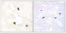 TP53I11 / PIG11 Antibody - Peptide - + Immunohistochemistry analysis of paraffin-embedded human brain tissue using TP53I11 antibody.
