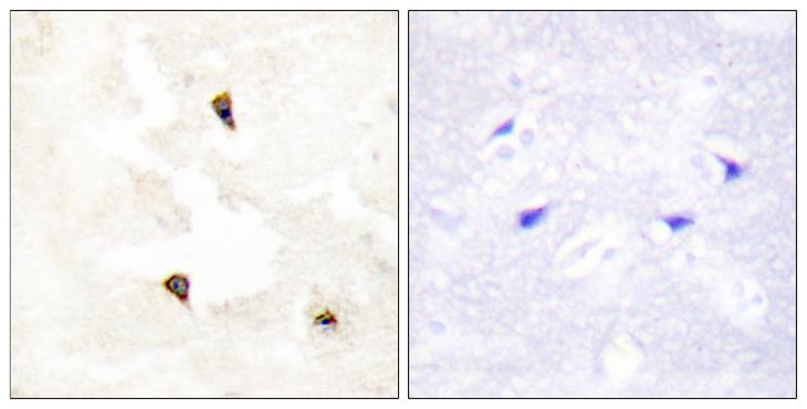 TP53I11 / PIG11 Antibody - Peptide - + Immunohistochemistry analysis of paraffin-embedded human brain tissue using TP53I11 antibody.