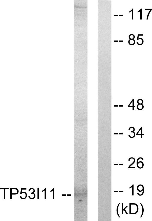 TP53I11 / PIG11 Antibody - Western blot analysis of extracts from HUVEC cells, using TP53I11 antibody.