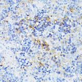 TP53I11 / PIG11 Antibody - Immunohistochemistry of paraffin-embedded Rat spleen using TP53I11 Polyclonal Antibody at dilution of 1:100 (40x lens).