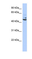 TP53I13 Antibody - TP53I13 antibody Western blot of OVCAR-3 cell lysate. This image was taken for the unconjugated form of this product. Other forms have not been tested.