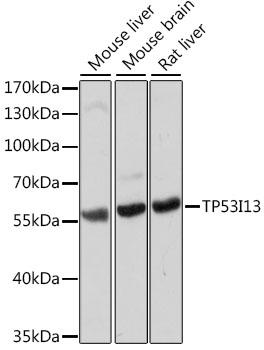 TP53I13 Antibody - Western blot analysis of extracts of various cell lines using TP53I13 Polyclonal Antibody at dilution of 1:1000.
