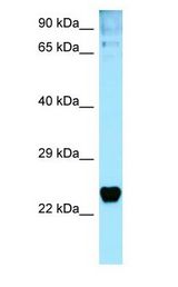 TP53I3 / PIG3 Antibody - TP53I3 / PIG3 antibody Western Blot of MCF7.  This image was taken for the unconjugated form of this product. Other forms have not been tested.