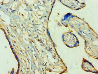 TP53I3 / PIG3 Antibody - Immunohistochemistry of paraffin-embedded human placenta using antibody at 1:100 dilution.