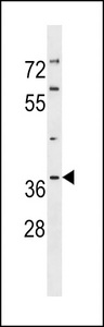 TP53I3 / PIG3 Antibody - PIG3 Antibody western blot of NCI-H460 cell line lysates (35 ug/lane). The PIG3 antibody detected the PIG3 protein (arrow).
